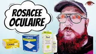 Soulager les yeux irrités par la rosacée oculaire et la blépharite [upl. by Azarcon323]