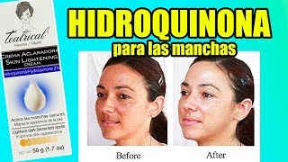 Crema hidroquinona para manchas en la cara [upl. by Bomke303]