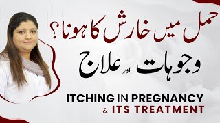 Know amp Treat Your Itching During Pregnancy  Hamal Mein Kharish [upl. by Sherilyn]