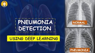 PNEUMONIA Detection Using Deep Learning in Tensorflow Keras amp Python  KNOWLEDGE DOCTOR [upl. by Neleb813]