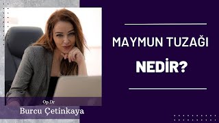 Maymun Tuzağı Nedir [upl. by Auoz]