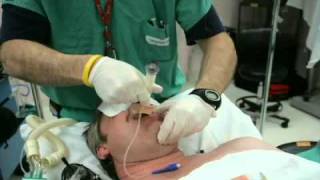 Technique of Placement of Extraglottic Devices Laryngeal Mask Airway Classic [upl. by Killian]