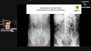 Urografia Excretora  Radiografia Simples do Abdome [upl. by Novelia]