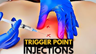 Trigger Point Therapy for Arm Pit and Shoulders [upl. by Tocci781]