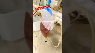 Comment the procedure Name  shorts dialysis ndt Plasmapheresis nephrology nephrodialysis [upl. by Aninaj999]