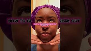 How to get rid of a breakout part one acne skincare panoxyl pimplepatch facewash 🧴☀️ [upl. by Runkel]