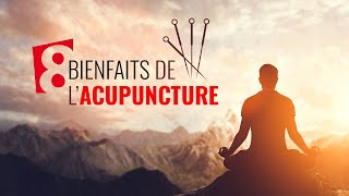 8 bienfaits de lacupuncture  Index Santé [upl. by Lon]