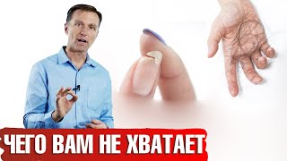 Почему выпадают волосы ломаются ногти и сухая кожа  Каких витаминов не хватает📣 [upl. by Rusticus]