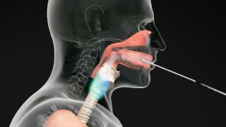 How do Straw Exercises Help the Voice Get Better voicetherapy [upl. by Hoon]