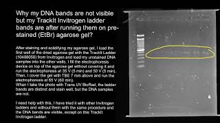 Gel electrophoresis faint bands [upl. by Cornew704]