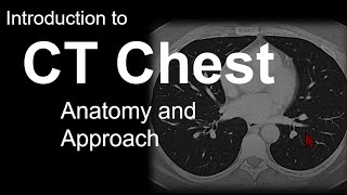 Introduction to CT Chest  Anatomy and Approach [upl. by Oijimer]