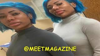 Clermont Twins new faces Plastic surgery has fans roasting them on Instagram War On Pretty [upl. by Elehcir299]