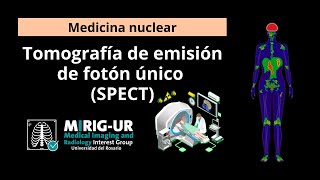 Tomografía por emisión de fotón único SPECT  Medicina nuclear  MIRIGURG [upl. by Aundrea]