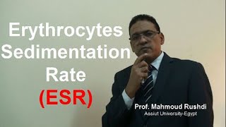 Erythrocytes Sedimentation Rate ESR  Lecture 2021 [upl. by Faubert911]