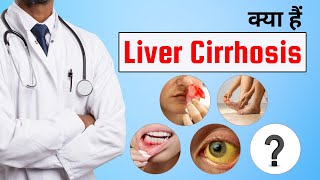 लिवर सिरोसिस क्या होता है  Liver Cirrhosis Ke Lakshan  Liver Cirrhosis Explained In Hindi [upl. by Tsew]