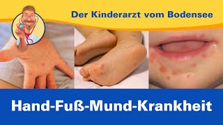 Mit HandFußMundKrankheit in den Kindergarten – Der Kinderarzt vom Bodensee [upl. by Neelrak]