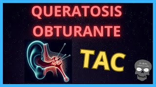 QUERATOSIS OBTURANTE en TOMOGRAFÍA 👂 [upl. by Eustazio815]