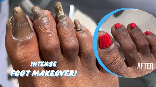 INTENSE FOOT MAKEOVER  PART 2 FINAL RESULT [upl. by Enilrae]