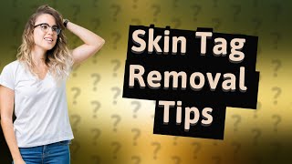 How to make a skin tag fall off [upl. by Burnham]