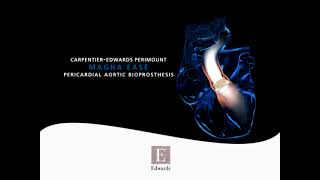 CarpentierEdwards PERIMOUNT Magna Ease aortic valve [upl. by Adok]