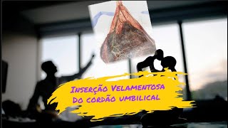 Inserção Velamentosa do Cordão Umbilical [upl. by Rubens]