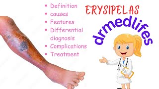 Erysipelas causes symptoms differential diagnosis complications treatment [upl. by Annola366]