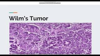 Wilms Tumor [upl. by Liam227]