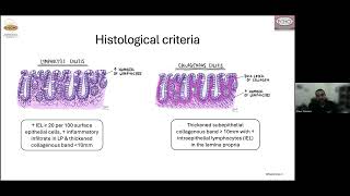 GECHO Medical Fellows  Microscopic colitis ischaemic colitis diversion colitis [upl. by Rodnas]