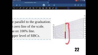 Hematocrit value  Practical hematology  Dr Saiko [upl. by Alix]