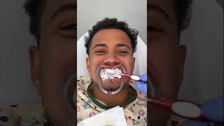 DIY Teeth Whitening Hack  Dentists Secret Ingredient Revealed [upl. by Notsyrb]