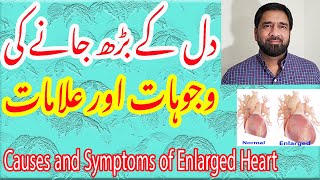 Heart Size  Signs amp Symptoms of enlarged heart  Hypertrophic Heart  Normal Heart in Urdu [upl. by Yla]