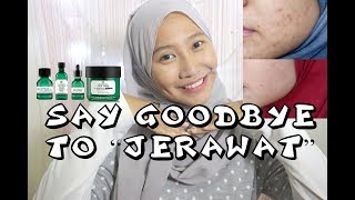 MY ACNE STORY  CARA MENGHILANGKAN JERAWAT DAN BRUNTUSAN PAKE PRODUK ALAMI 1 TEA TREE THE BODY SHOP [upl. by Nahsar]