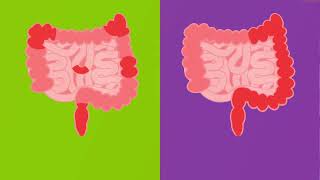 What Is Inflammatory Bowel Disease IBD  Connecticut Childrens [upl. by Borreri]