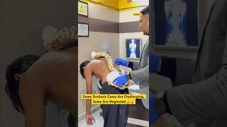 Rare Kyphoscoliosis case treatment by DrRavi kyphosis scoliosistreatment spine chiro reels [upl. by Aikas773]