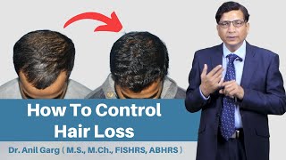 5 Tips on How To Stop Hair Loss And Regrow Hair Naturally  How To Control Hair Loss amp Solution [upl. by Aicinod]