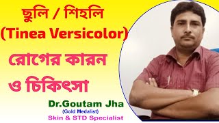 ছুলি বা শিহলি রোগের কারণ ও চিকিৎসা Causes and treatment of Pityriasis Versicolor [upl. by Harrod]