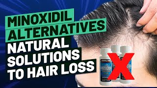 Minoxidil Alternatives  Natural Solutions to Hair Loss [upl. by Hui]