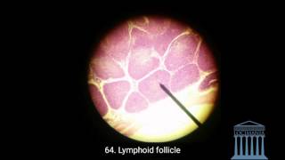 Histology  Vermiform Appendix [upl. by Luelle219]