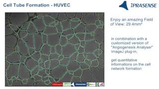 Cell Tube Formation  HUVEC on Matrigel [upl. by Nauqel]