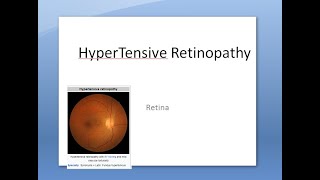 Ophthalmology 282 a Hypertensive Retinopathy HyperTension High Blood Pressure Eye Effect DisOrder [upl. by Abbate]