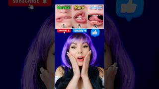 TrendVideoShorts جعل خيار واحد فقط shorts viral tiktok natalishik p411 [upl. by Schluter]