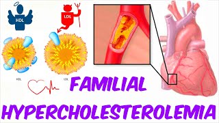 Familial Hypercholesterolemia High Cholesterol Levels [upl. by Anilag]