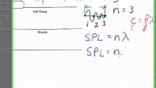 Ultrasound Physics Spatial Pulse Length SPL [upl. by O'Conner]