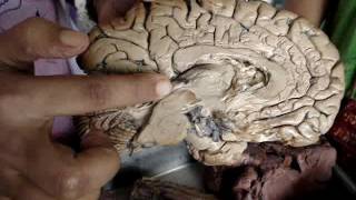 Brain anatomy by Dr Shilpi Mam MMC2 [upl. by Mathia]