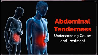 Abdominal Tenderness Top Medical Insights and Home Remedies [upl. by Alleris]