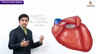 Ischemic Heart Disease  Coronary heart disease  Usmle step 1  Definition and Coronary blood flow [upl. by Sharman]