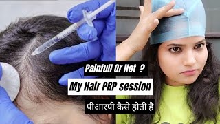 My hair PRP treatment  hair loss solution [upl. by Peery77]