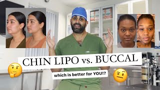 Chin Lipo vs Buccal Fat Removal WHICH IS BETTER [upl. by Serafina]