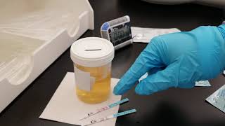 Chemistry Urine Fertility Screening Tests [upl. by Victor]