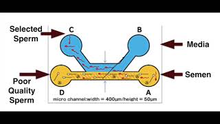 Sperm separation by Microfluidics at AIVF  Qualis [upl. by Mclaurin]